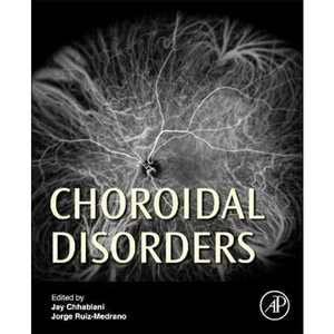 The Book Depository Choroidal Disorders by Jay Chhablani