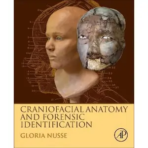 The Book Depository Craniofacial Anatomy and Forensic Identification by Gloria Nusse